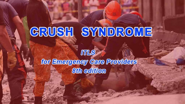 Crush syndrome. Особливості догоспітального етапу
